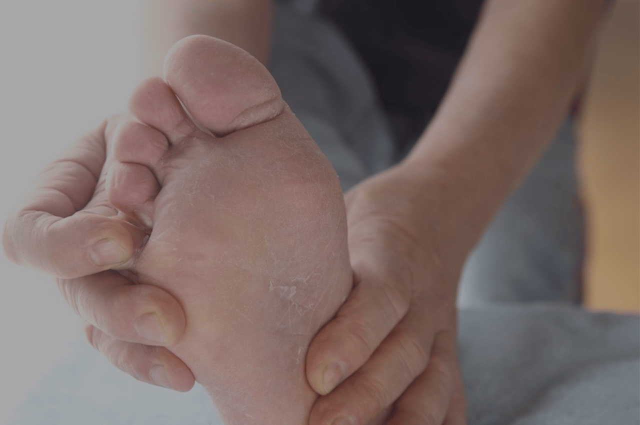 athletes foot sufferer wondering if an athletes foot home remedy is right for them athletes foot sufferer wondering if an athletes foot home remedy is right for them