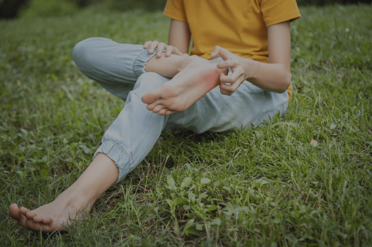 child with itchy red foot could be athletes foot in kids