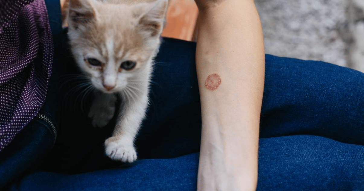 itchy red circular rash caused by ring worm from a cat