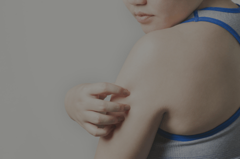 woman with ringworm from the gym wondering how to prevent jock itch and ringworm from the gym
