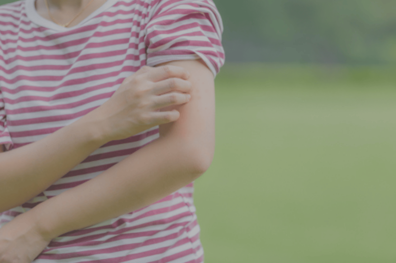 woman debating ringworm causes while scratching ringworm rash woman debating ringworm causes while scratching ringworm rash
