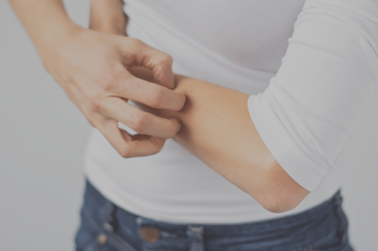 woman scratches dry skin which is one of the possible ringworm symptoms woman scratches dry skin which is one of the possible ringworm symptoms