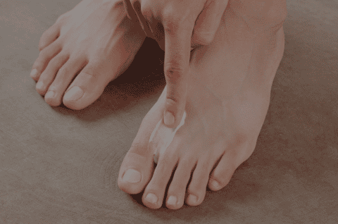 cure athletes foot at home fast with silka cream
