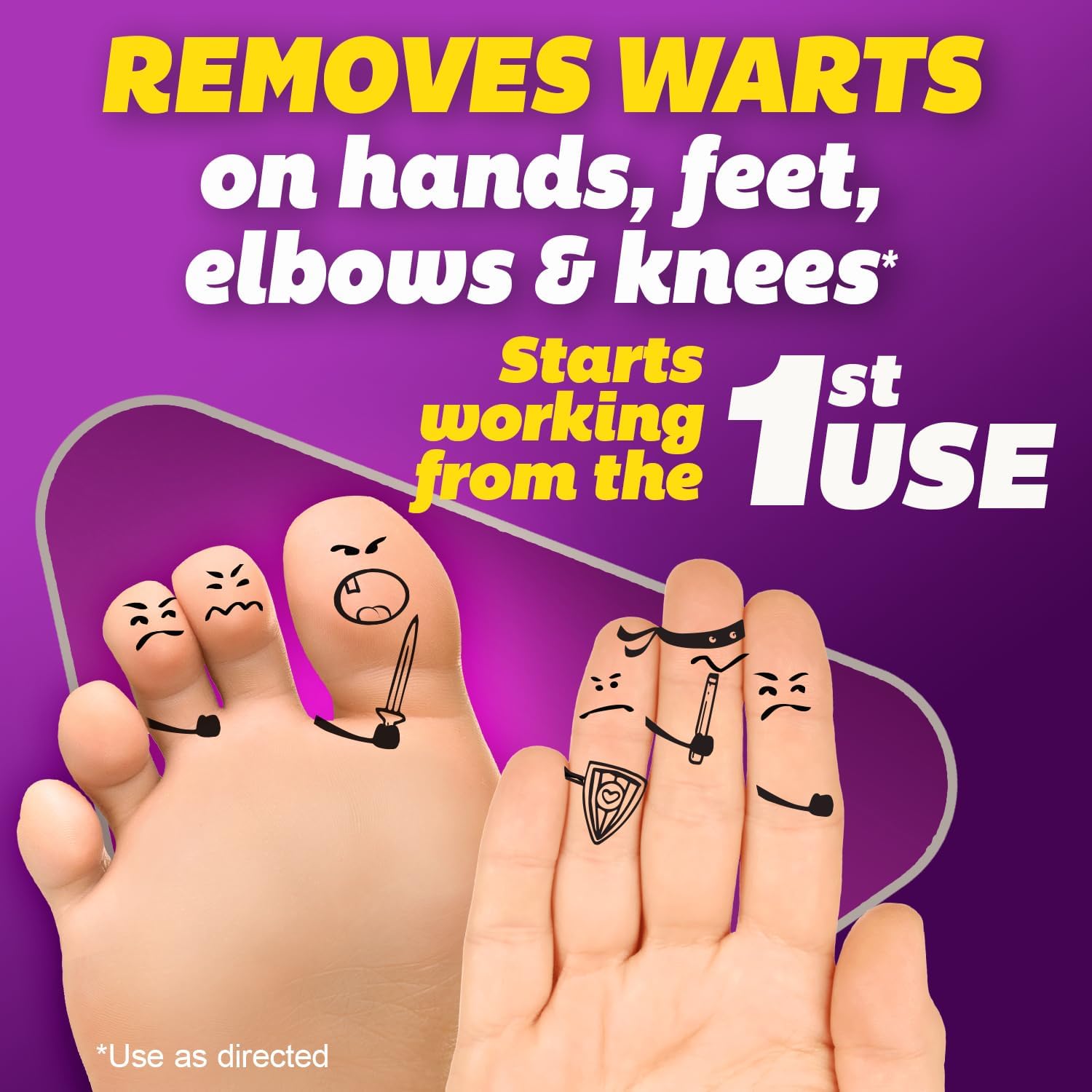2-silka-pointts-wart
