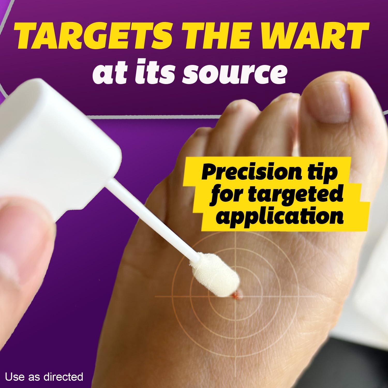 4-silka-pointts-wart
